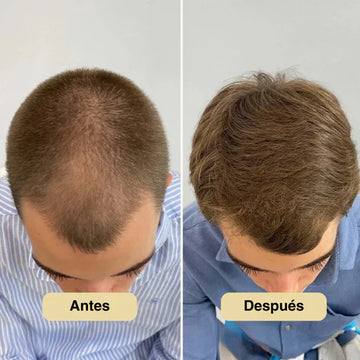 Renueva tu confianza con un cabello radiante.