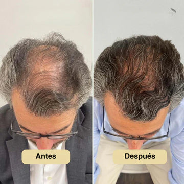 Renueva tu confianza con un cabello radiante.